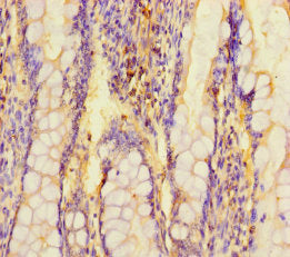 ARL15 Antibody
