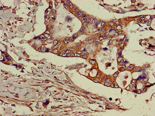 GGA3 Antibody