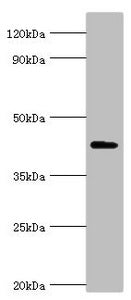 AIPL1 Antibody