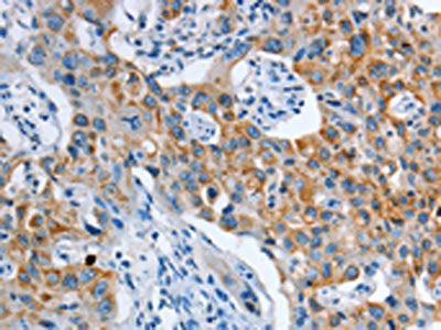ASL Antibody