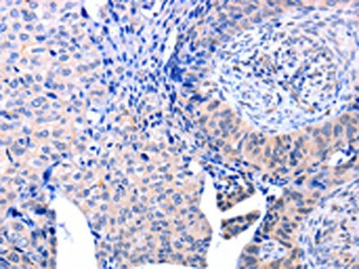 ACAD10 Antibody