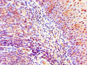 ASH2L Antibody