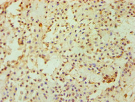 DKK4 Antibody