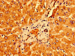 PSORS1C1 Antibody