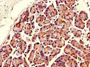 SLCO3A1 Antibody