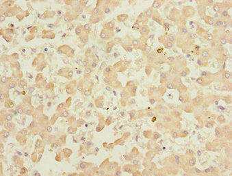 KLF15 Antibody