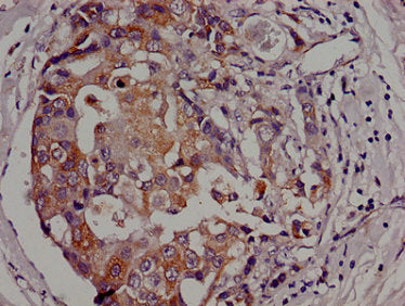 AK3 Antibody