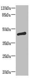 ST6GALNAC2 Antibody