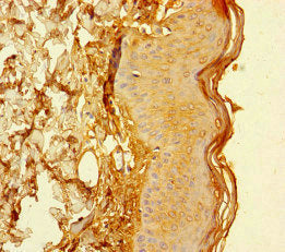 CYREN Antibody