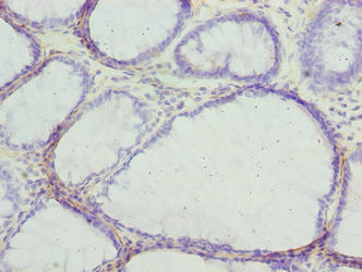 GSDMC Antibody
