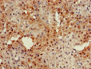 PKIB Antibody