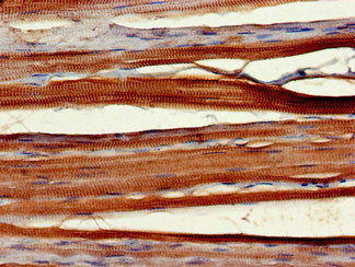 WNT10A Antibody