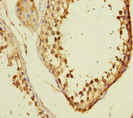VPS33B Antibody