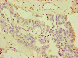 CDCP1 Antibody