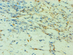 SMYD3 Antibody