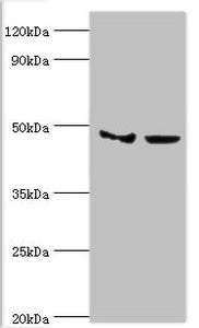 SMYD3 Antibody