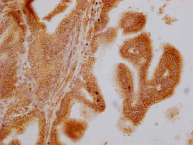 SLC28A3 Antibody