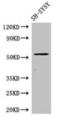 METTL14 Antibody