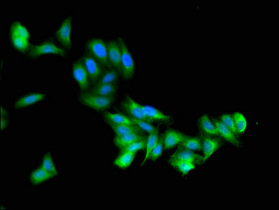 ZSWIM6 Antibody