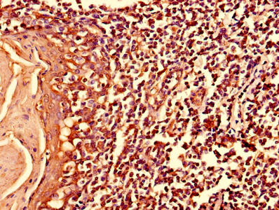 MYO10 Antibody