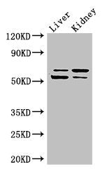 LMBRD1 Antibody