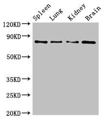 PRMT7 Antibody
