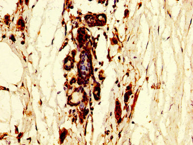 POLR3B Antibody