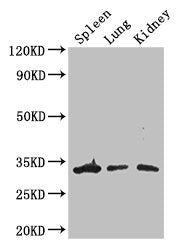 ALKBH4 Antibody
