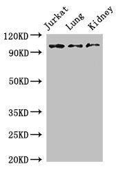 SMARCAL1 Antibody