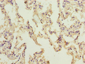 NINJ2 Antibody