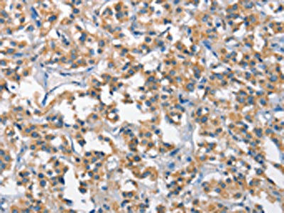 SCARB1 Antibody