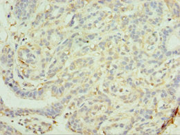 MAGEC2 Antibody