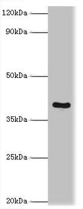 TNFRSF10D Antibody