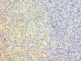 TNFRSF10D Antibody