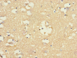 CHRNA9 Antibody