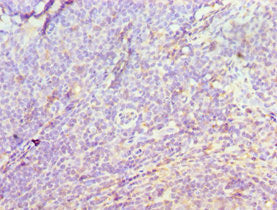 DIDO1 Antibody