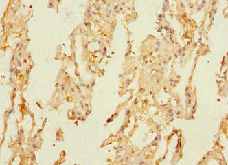 DUSP16 Antibody