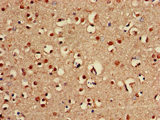 ABCA2 Antibody