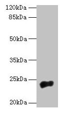 NACA2 Antibody