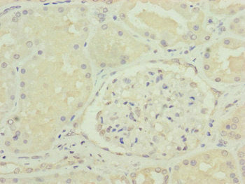 VPS11 Antibody