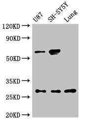 NEUROG2 Antibody