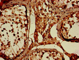 WNK1 Antibody
