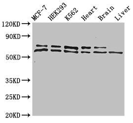 ACAD9 Antibody