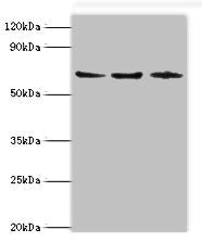 ACAD9 Antibody