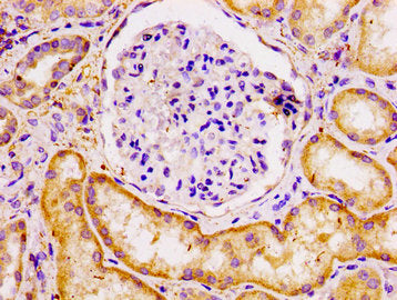 ECT2 Antibody