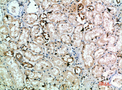 KLRK1 Antibody