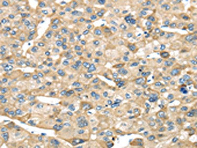 NME8 Antibody