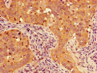 TIGAR Antibody