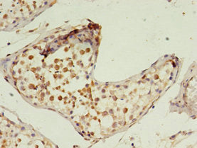 PRTFDC1 Antibody