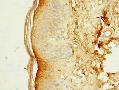 SLC38A7 Antibody